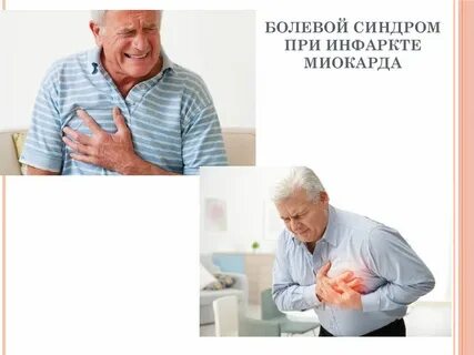 Болевой инфаркт
