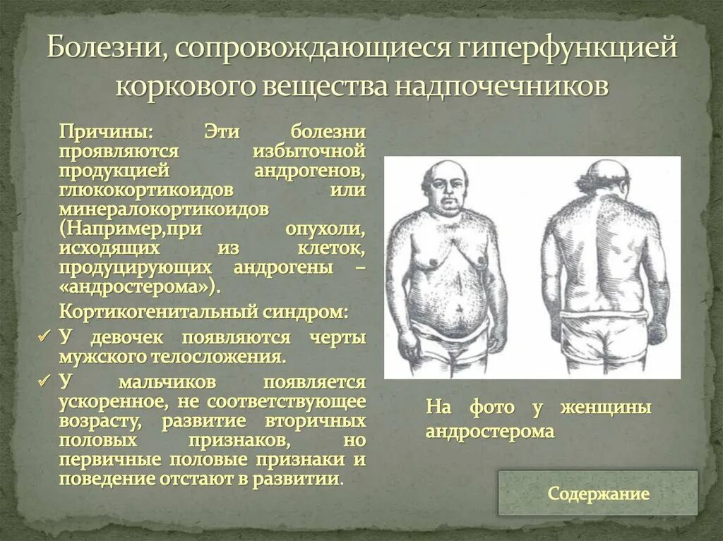 Болят ли надпочечники. Нарушения при гипофункции надпочечников. Симптомы при заболевании надпочечников. Эндокринные нарушения надпочечников. Гипо и гиперфункция коры надпочечников.