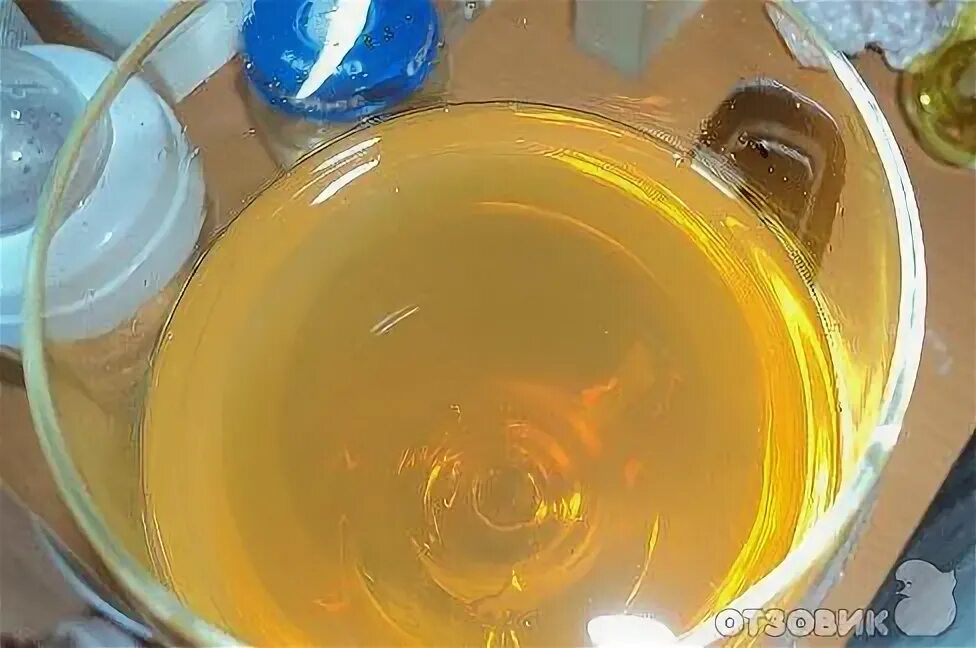 Моча мутного цвета. Осадок в моче. Моча фото. Мутная моча. Нормальная моча.