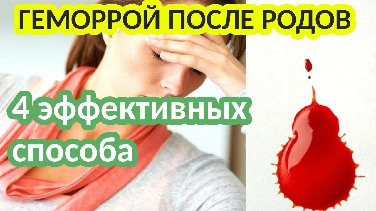 Геморрой при гв. Натальсид свечи. Геморрой при гв. Свечи при геморрое в период лактации. Мазь для геморроя после родов.