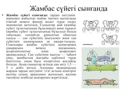 Қыздың жамбас аймағындағы кончаткалар фотосы