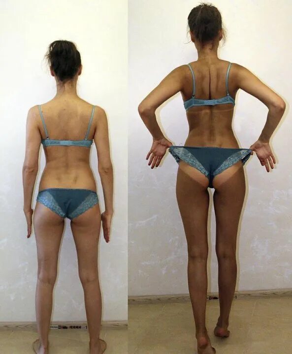 моментальный загар до и после. солярий до и после. меланотан 1. после солярия. солярий до и после результаты.