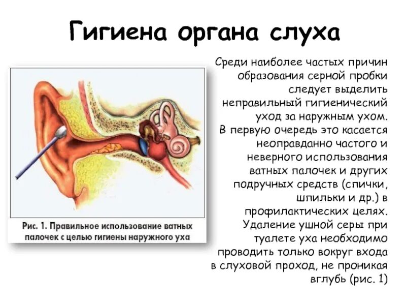 Серная пробка манипуляция. Повреждение ушной перепонки ватной палочкой. Наружный слуховой проход серная пробка. Строение ушной раковины для чистки ушей.