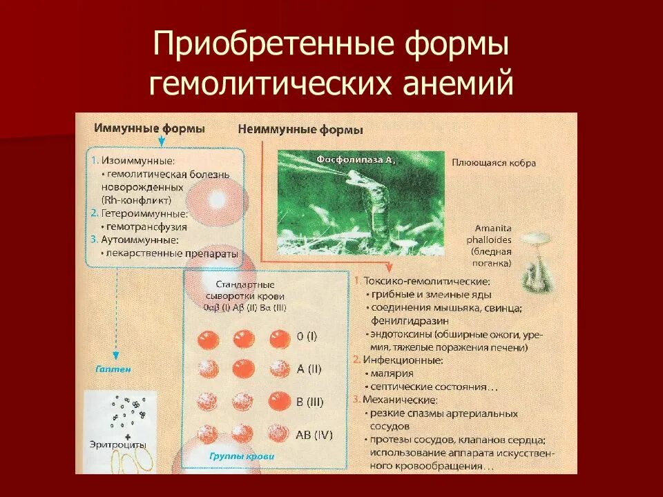 Гемолитическая анемия эритроциты форма. Иммунная гемолитическая анемия. Приобретенные гемолитические анемии. Приобретенные иммунные гемолитические анемии.