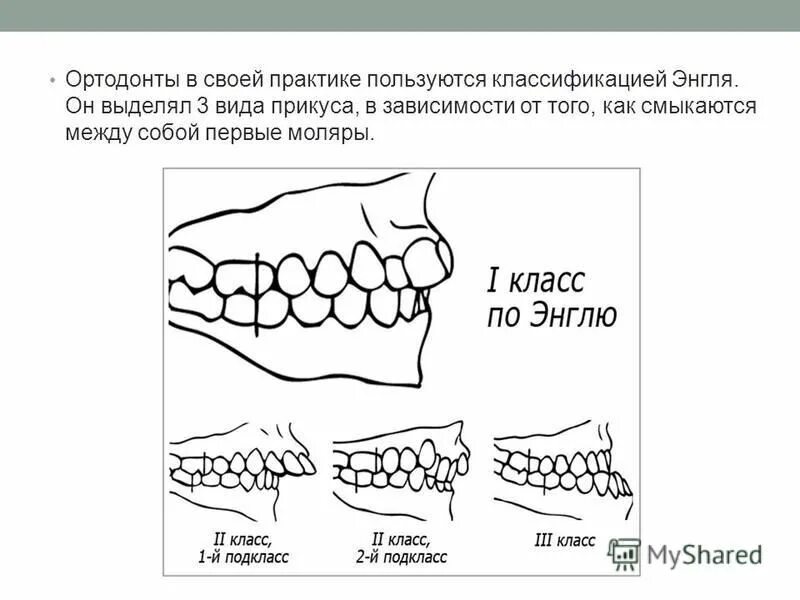 Ортогнатический прикус схема. Патологический прогенический прикус. Артикуляция окклюзия прикус. Сагиттальная окклюзионная кривая (кривая шпее). Ортогнатический прикус постановка зубов.