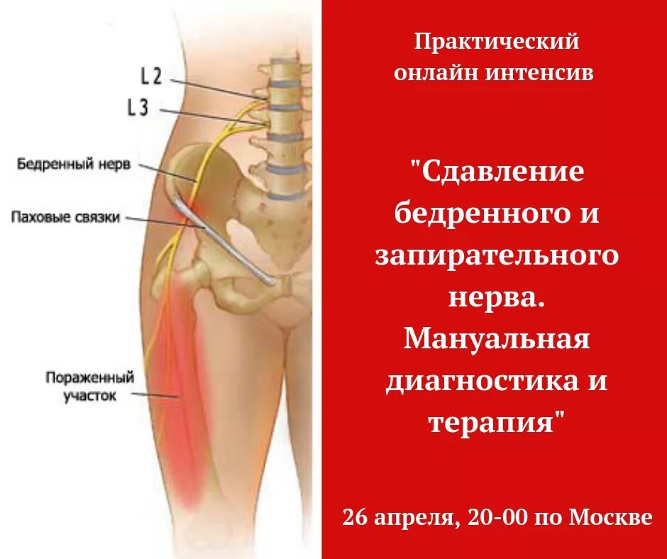 Симптомы характерные для поражения бедренного нерва:. Иннервация кожи голени анатомия. Мералгия рота бернгардта. Наружный латеральный нерв бедра. Ишиалгия даволаш.