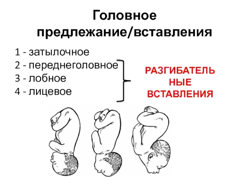 Продольное головное предлежание 2 позиция. Лобное предлежание плода биомеханизм родов. Головное предлежание продольное вид задний. Головное предлежание плода задний вид. Первое положение плода