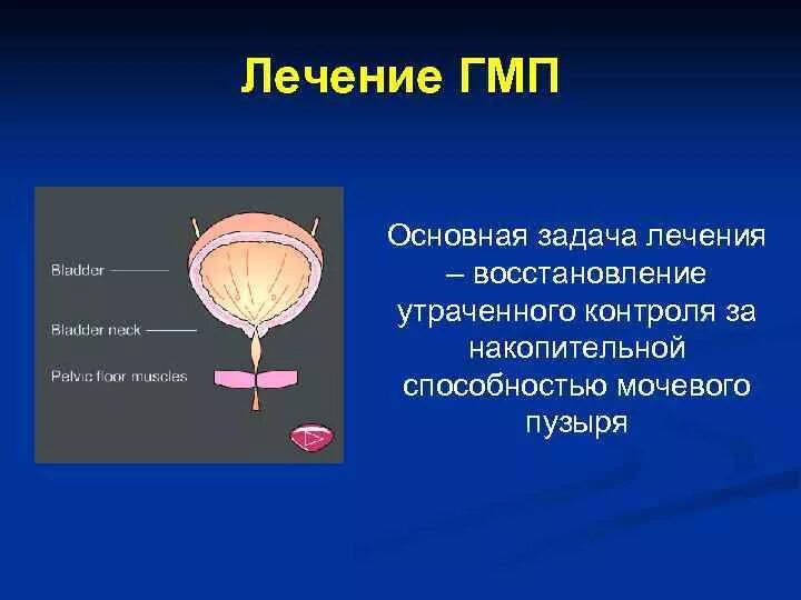 Мочевой пузырь. Гиперреактивный мочевой пузырь. Терапии гиперактивного мочевого пузыря. Гиперчувствительный мочевой пузырь. Мочевой пузырь после 60 лет