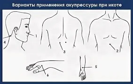 Икота у мужчины причины. Способы избавления от икоты. Что делать при икоте. Иглоукалывание при икоте. Как быстро Остановить икоту.