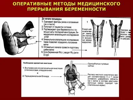 Блокада инструкция