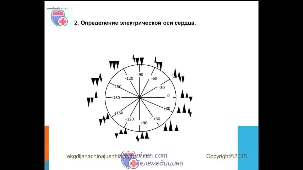 Как определить ось сердца. Электрическая ось сердца угол альфа. электрическая ось сердца на экг таблица. электрическая ось сердца как определить. электрическая ось сердца на экг как определить.