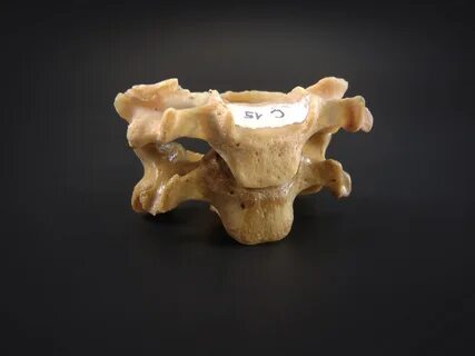 Vertebrae