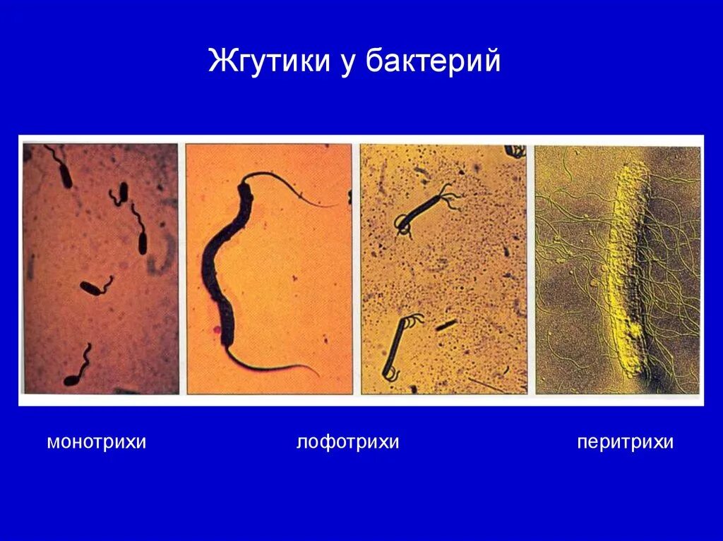 Лофотрихи. Монотрихи перитрихи. Монотрихи лофотрихи. Жгутики микроорганизмов перитрихи. Лофотрихи это бактерии.