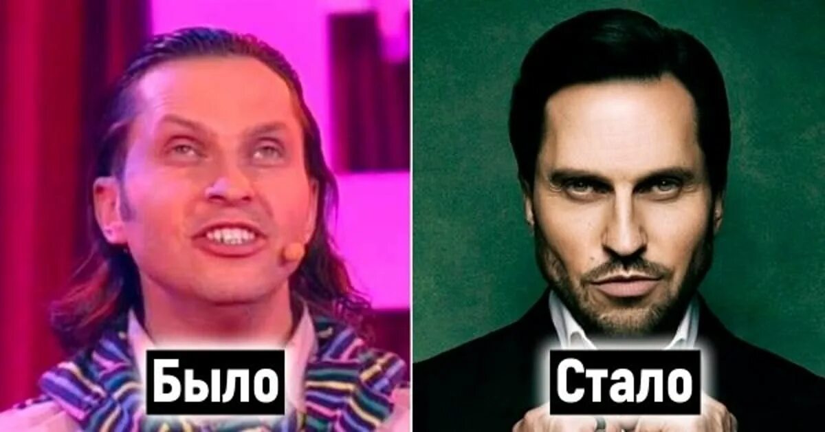 Ревва александр до пластики. Фото пирожкова до и после пластики. Александр ревва. Рева александр в молодости. Ревва александр до пластики.