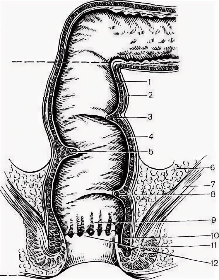 Каким номером на рисунке обозначена прямая кишка. Мышечный слой прямой кишки. Отделы прямой кишки анатомия. Анатомические образования слизистой оболочки прямой кишки. Нижняя поперечная складка прямой кишки.