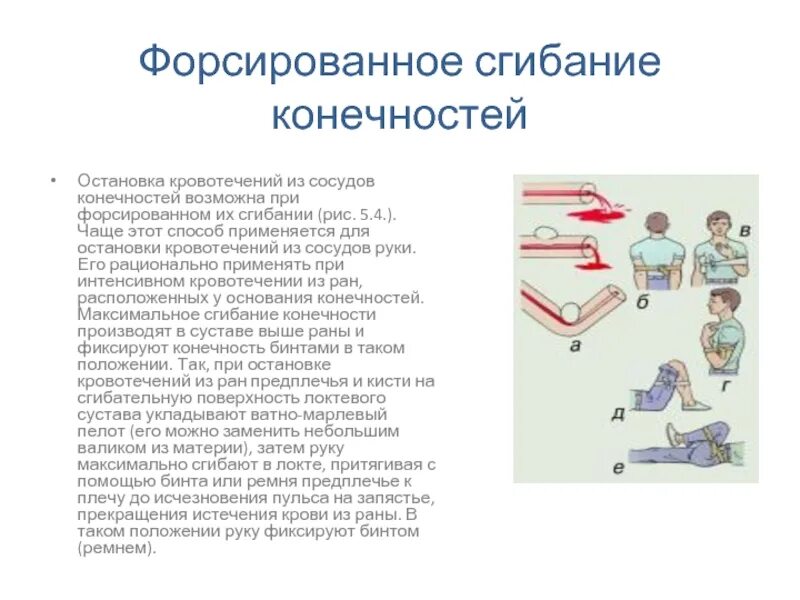 Остановка кровотечения путем сгибания конечности. Форсированное сгибание конечности. Форсированное сгиьание конечносности. Форсированное сгибание конечности при кровотечении. Максимальное сгибание конечности.