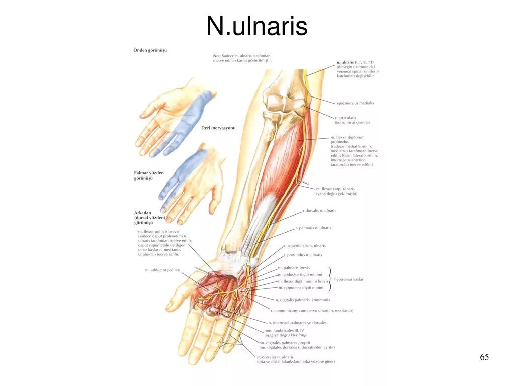 Локтевой нерв топография. Лучевой локтевой нерв защемление. Туннельный синдром локтевого нерва. Неврит (невропатия) локтевого нерва. Синдром компрессии лучевого нерва.
