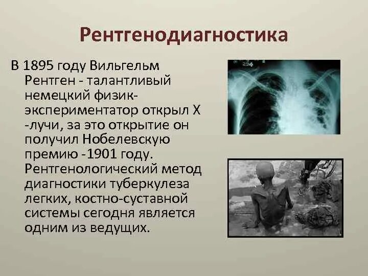 Туберкулёз презинтация. Туберкулез презентация. Туберкулёз презентация по медицине. История туберкулеза.