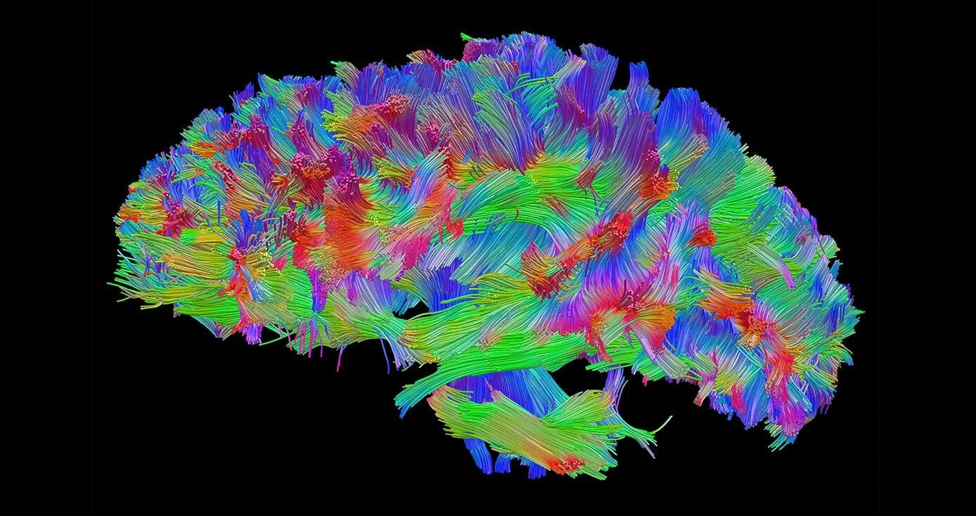 Коннектом москва. Коннектом человека проект. Коннектом человека. Complexity theory. Коннектом москва.