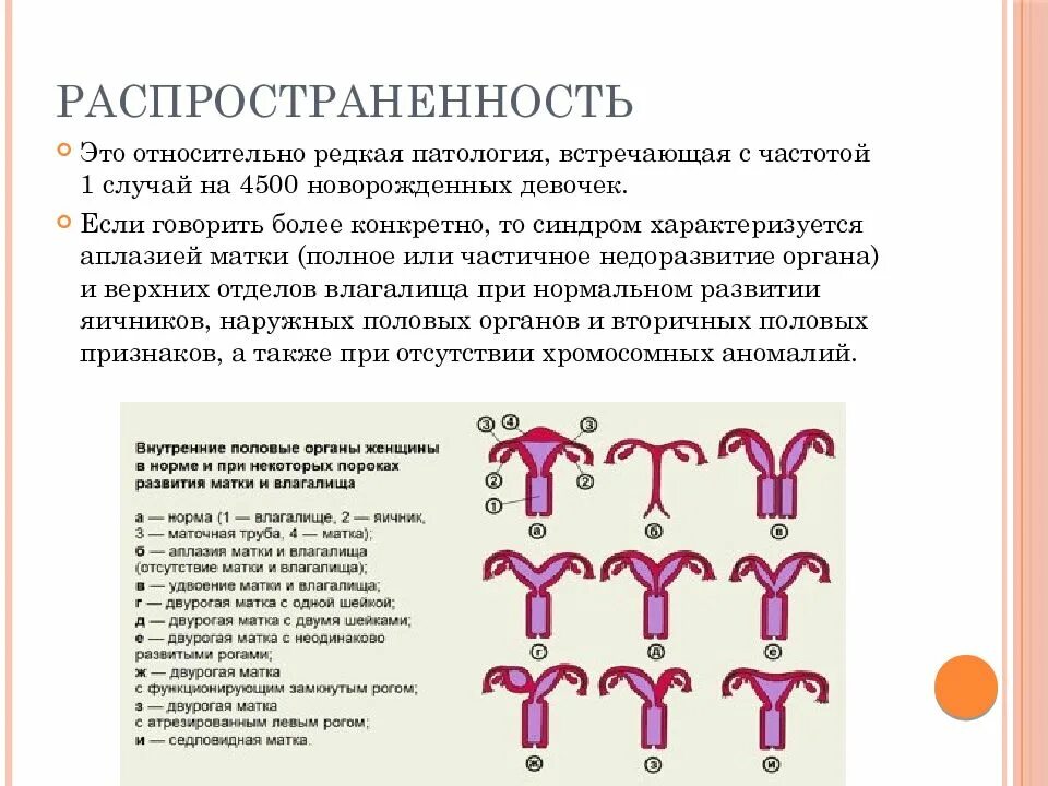 Синдром рокитанского кюстера хаузера. Синдром майера-рокитанского-кюстнера. синдром рокитанского кюстнера фото. синдром майера — рокитанского — кустера — хаузера.