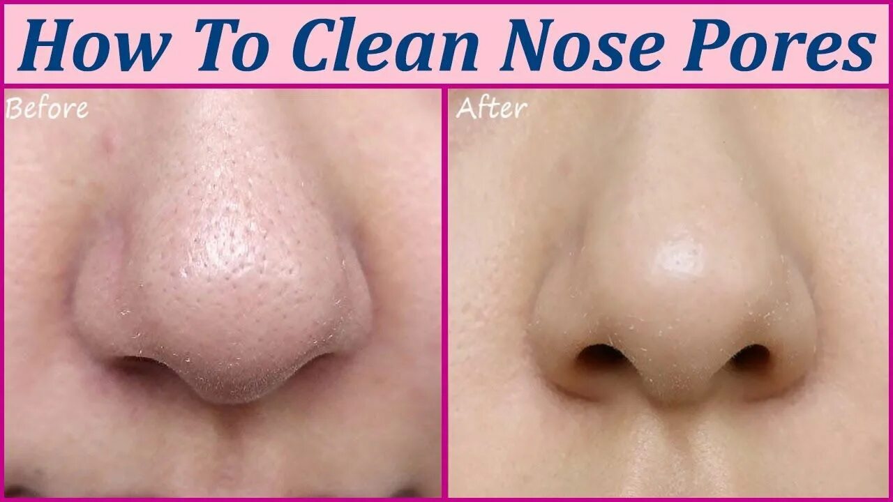 Clean nose. Nose clean турецкое.