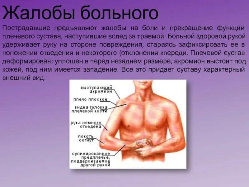 Вывих плечевого сустава локальный статус. Симптомы при вывихе плечевого сустава. Жалобы при вывихе плечевого сустава. Статус локалис суставов