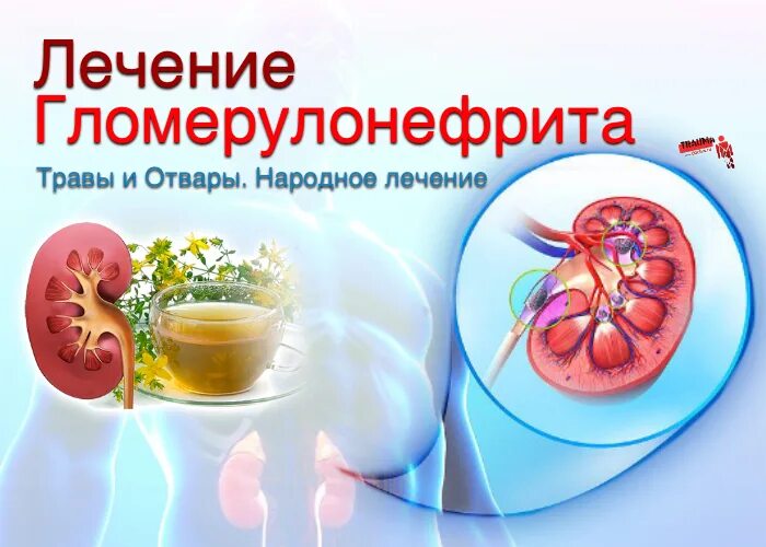 Лечение гломерулонефрита препараты. Гломерулонефрит фитотерапия. фитотерапия гломерулонефрита хронического. терапия гломерулонефрита. гломерулонефрит фитопрепараты.