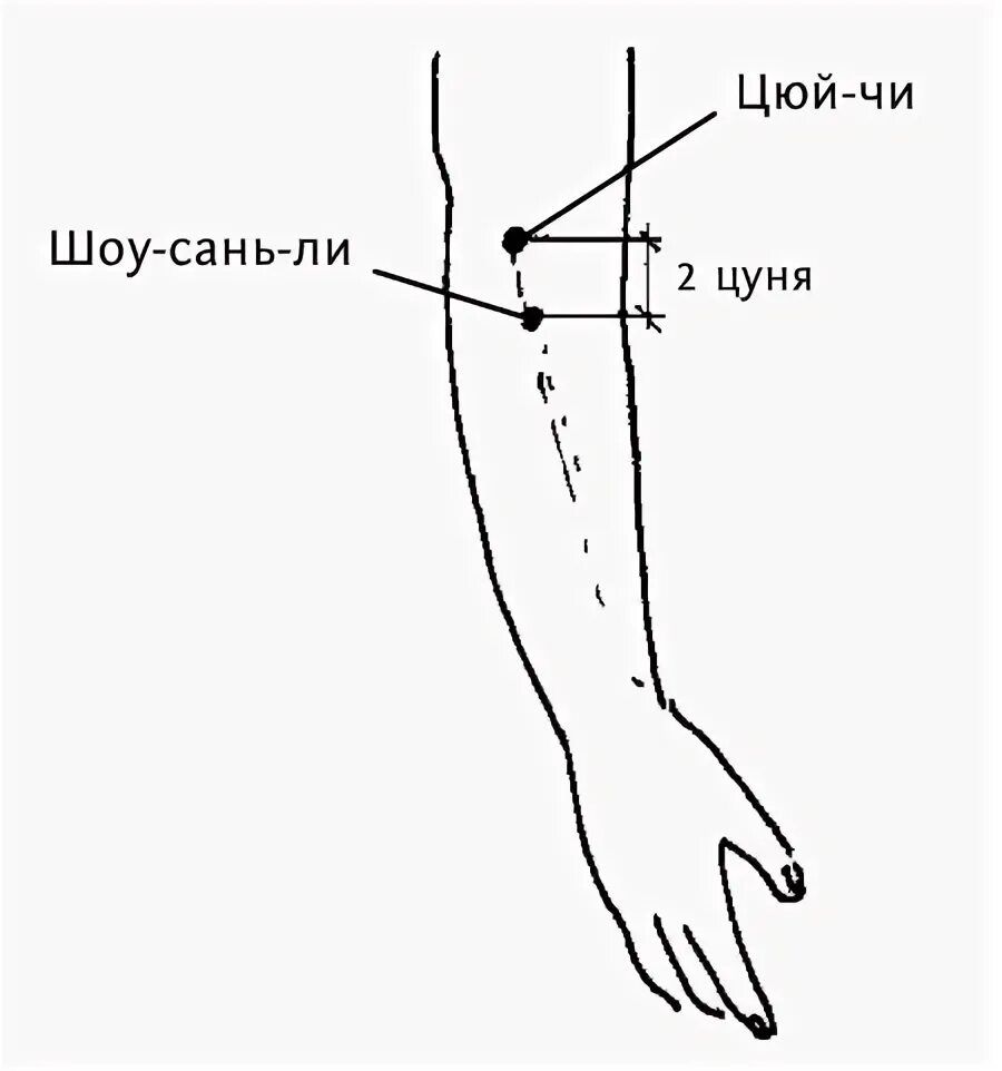 Li 11 точка акупунктуры. Точка цюй чи. Точка цюй чи. Цюй чи точка на локтевом сгибе. Точка цюй чи.