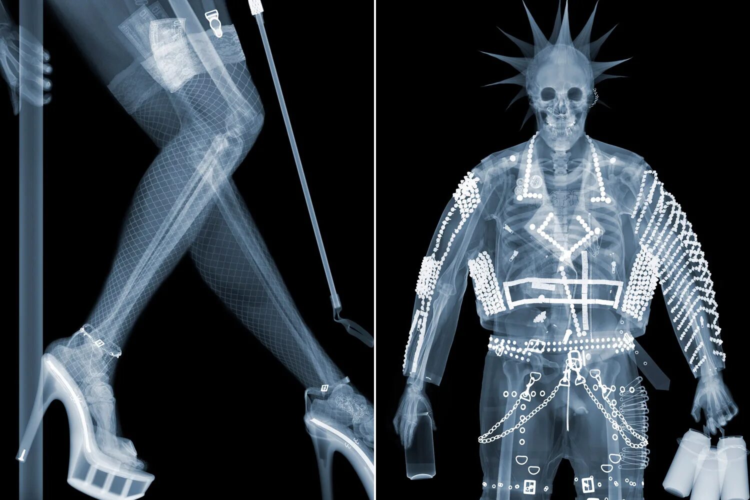 Рентген можно сделать. XRAY рентген. Человек в рентгеновских лучах. Съемка в рентгеновских лучах. Старые рентгеновские снимки.