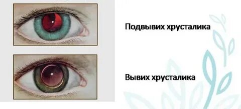 Когда меняют хрусталик