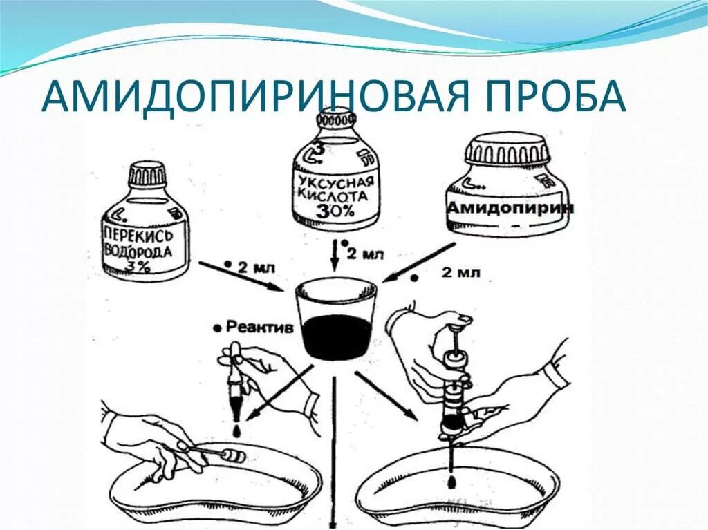 Положительная азопирамовая проба. Азопирамовая проба амидопириновая проба фенолфталеиновая проба. Пробы Азопирамовая и фенолфталеиновая и амидопириновая. Амидопириновая проба (на наличие крови).. Технология постановки амидопириновой пробы.