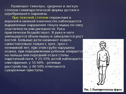 Степени дцп