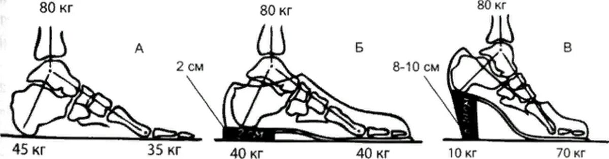 Физики подошва. Стопа распределение веса. Стопы с нагрузкой. Распределение нагрузки на стопу. Правильная нагрузка на стопу.