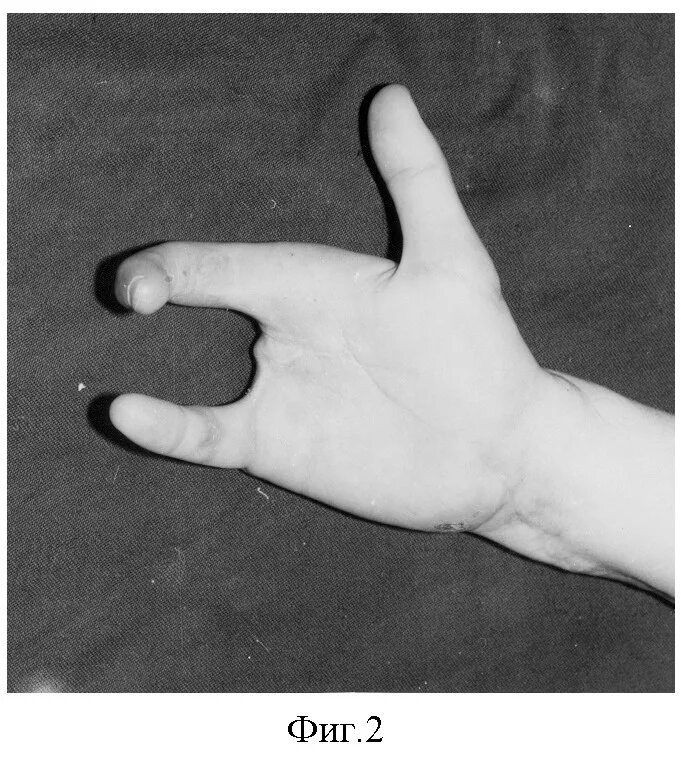 кольца на фаланги пальцев серебро санлайт. две фаланги на пальцах. две фаланги на пальцах. две фаланги на пальцах. кольцо жади на две фаланги.