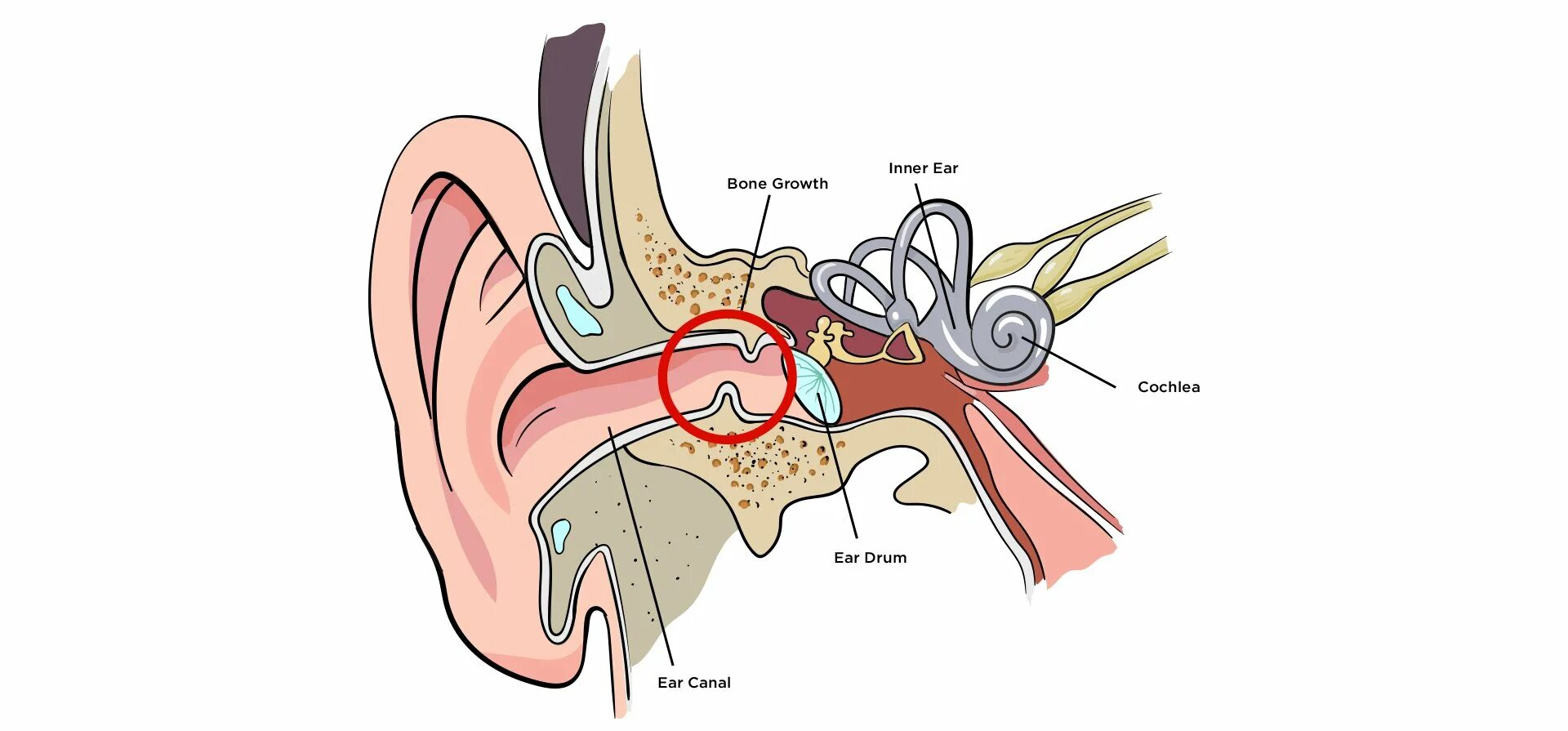 Вода в ухе. The Mind's Ear.