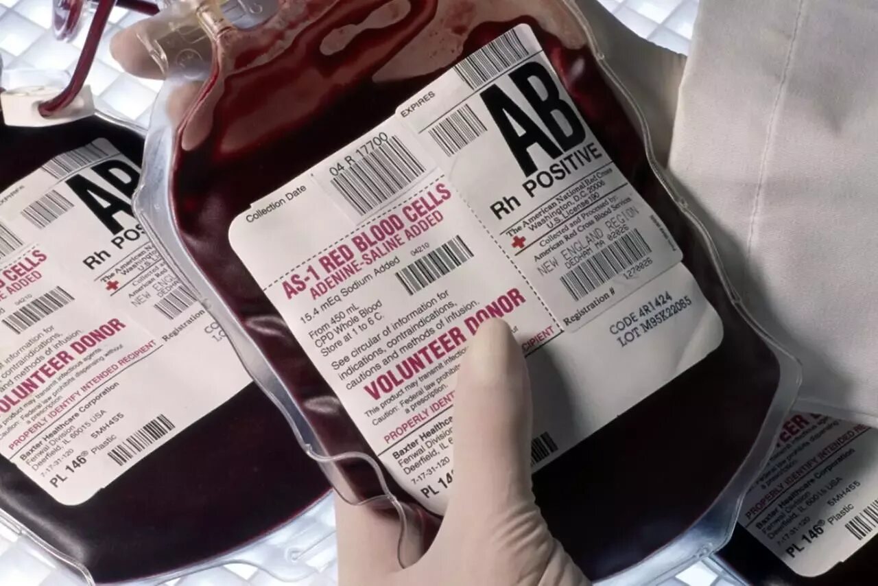 Blood Groups Universal donor. Ферментированная кровь что это. Packed Red Blood Cells.