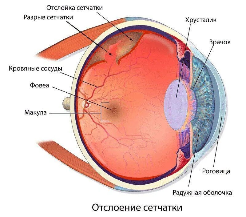 После операции сетчатки глаза ограничения. Отслойка сетчатки глаза. Сетчатка глаза. Строение глаза без подписей. Структура глаза человека.