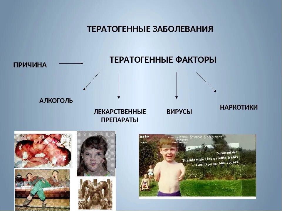 Наследственные заболевания бывают. Наследственные заболевания. Генетические заболевания человека. Наследственные генетические заболевания. Распространенные наследственные заболевания.