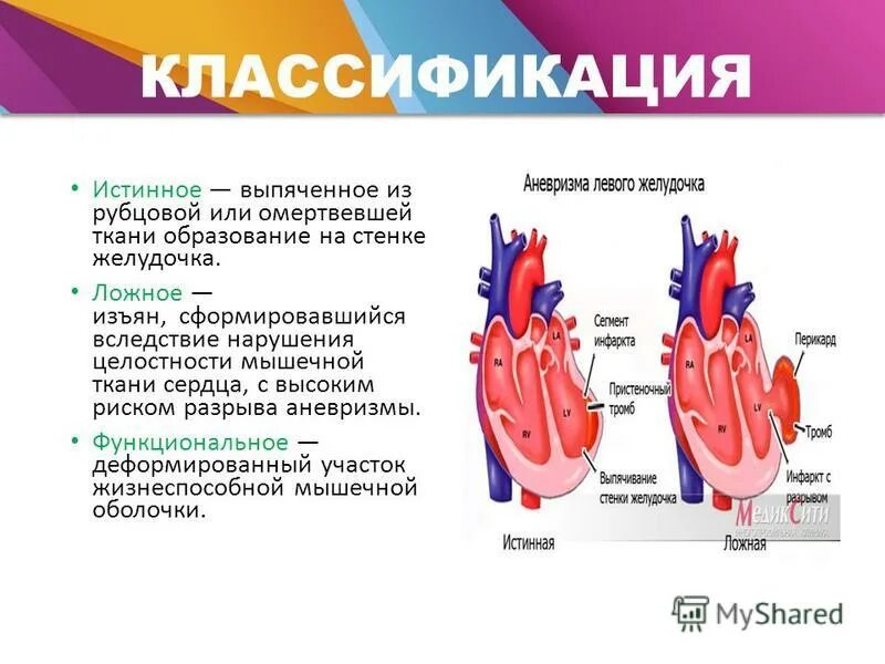 атриовентрикулярных клапанов. клапан правого предсердно-желудочкового отверстия. доклад про сердце. камеры сердца анатомия. ушки предсердий анатомия.