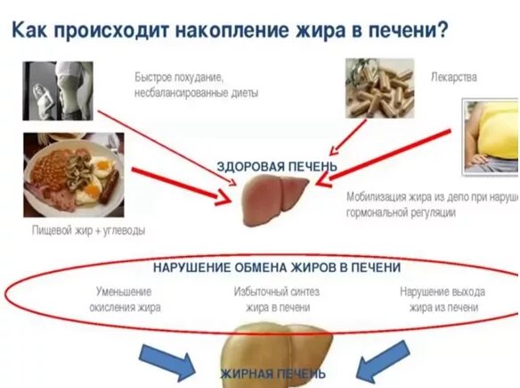 Кофе при жировом гепатозе можно. Диета при гепатозе печени стол 5 меню. диета при жировом гепатозе. диета прижиравом гипатозе. жировой гепатоз печени диета.