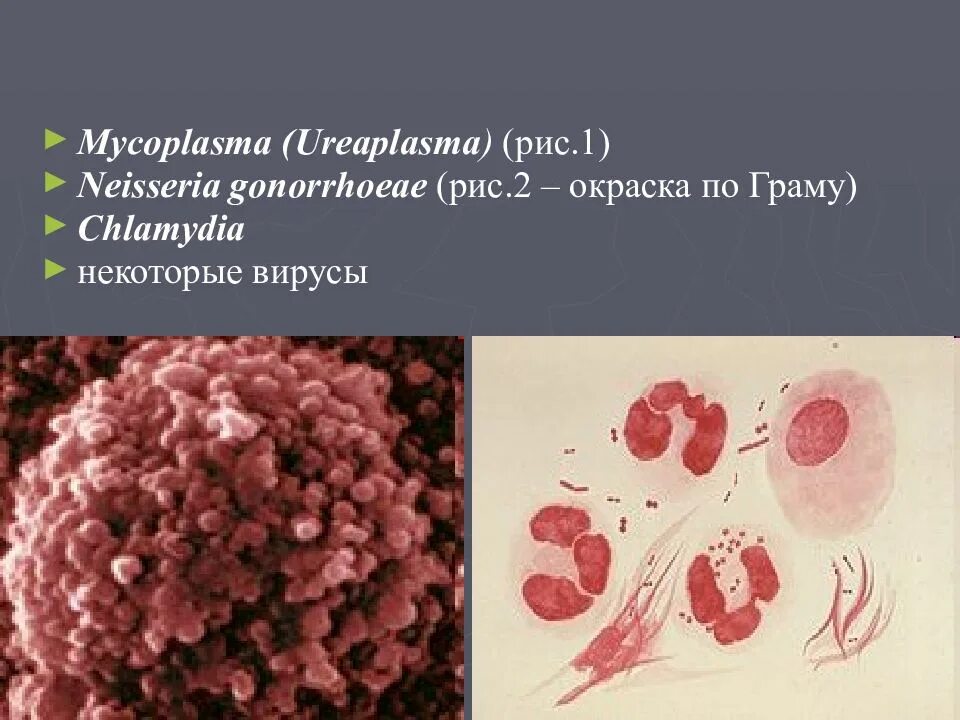 Уреаплазма у мужчин причины. Микоплазма уреалитикум. Микоплазма и уреаплазма. Уреаплазма уреалитикум.