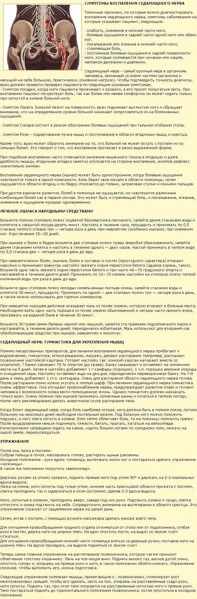 Седалищный нерв лечение у мужчин препараты. Воспаление седалищного нерва. Воспале5иеиседалищного нерва. Воспаление седалищного нерва лечение. Воспаление седалищного нерва симптомы и лечение.