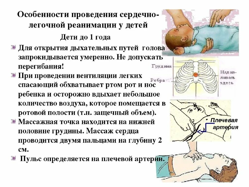 Частота надавливаний при проведении реанимации составляет. Непрямой массаж сердца алгоритм действий детям. Сердечно-лёгочная реанимация (СЛР) У детей. СЛР детям до 1 года алгоритм.