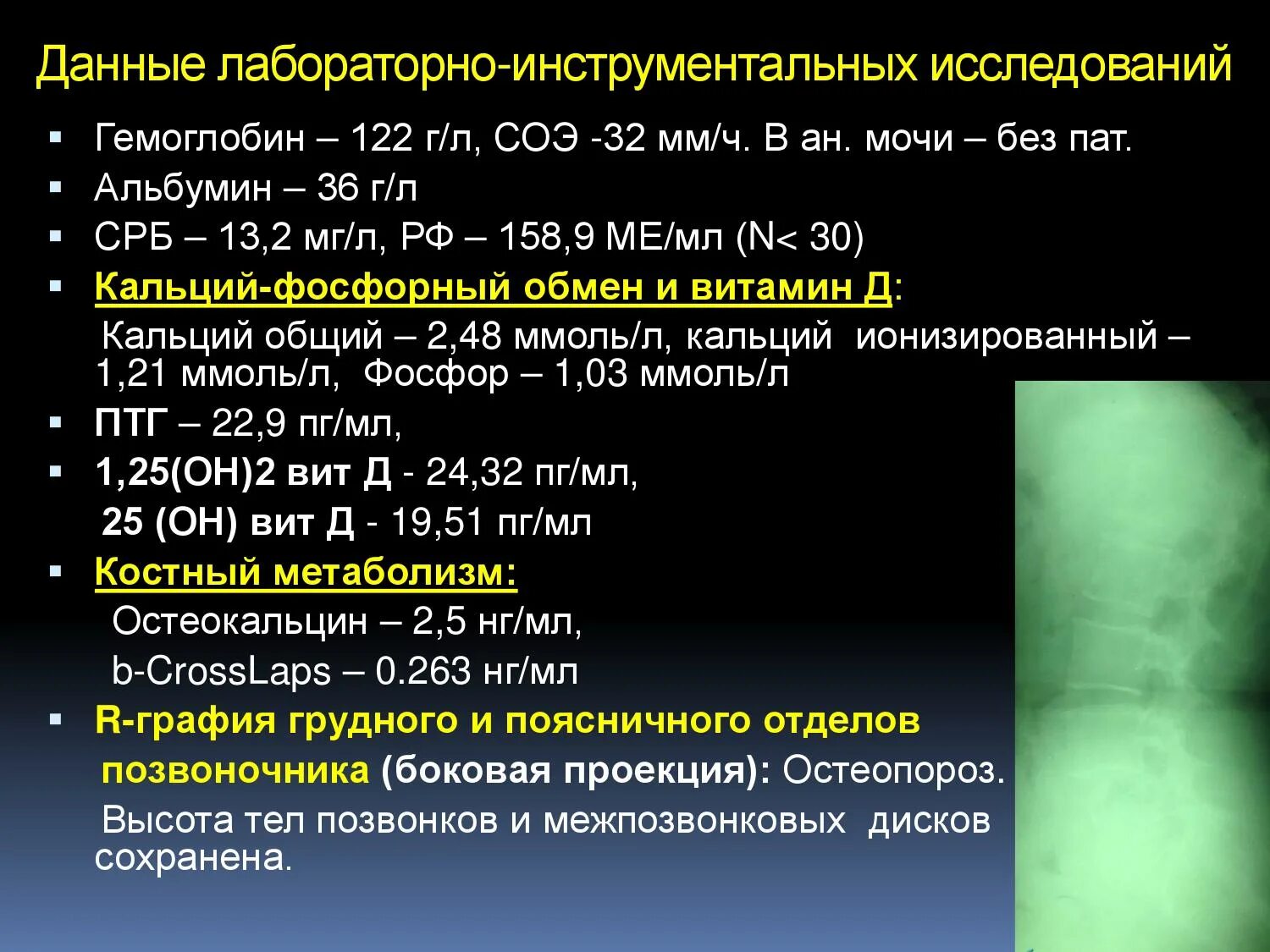 Дипроспан при артрите. Лабораторные данные при ревматоидном артрите. инструментальные исследования при ревматоидном артрите. ревматоидный артрит срб. саркопения клинические рекомендации.