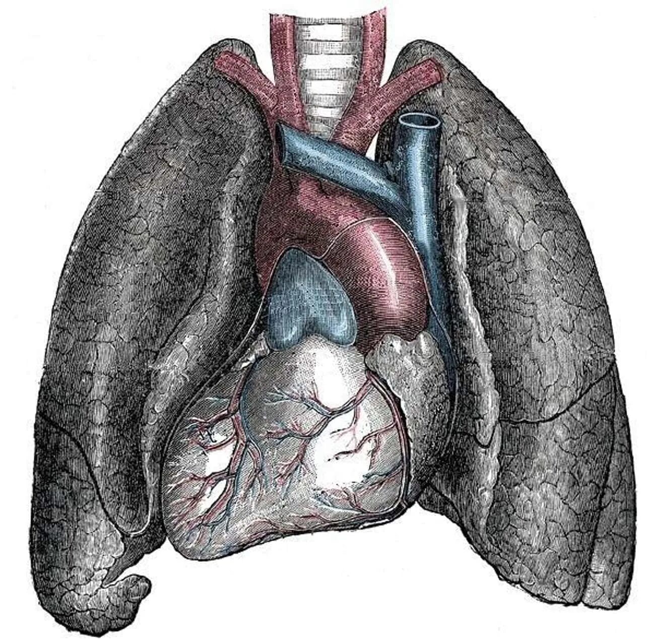 Ситус висцерус инверзус. Infundibulum анатомия сердца.