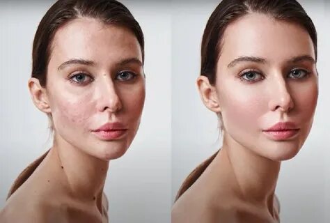 Retouch4me 1.019