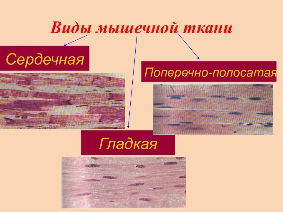 Скелетная сердечная и гладкая мышечная ткань. Сердечные поперечнополосатые мышечные ткани. Поперечно-полосатая сердечная мышечная ткань препарат. Поперечно полосатая сердечная мышечная ткань функции. Отличие гладкой и поперечно полосатой ткани