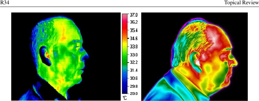 Температура затылка. Инфракрасное излучение термография. Тепловизор человек. Термография лица. Лицо человека тепловизор.