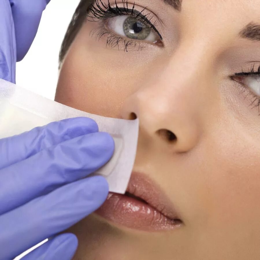 Эпиляция над губой. Эпиляция губы. Депиляция усики. Шугаринг лица. Эпиляция губы.