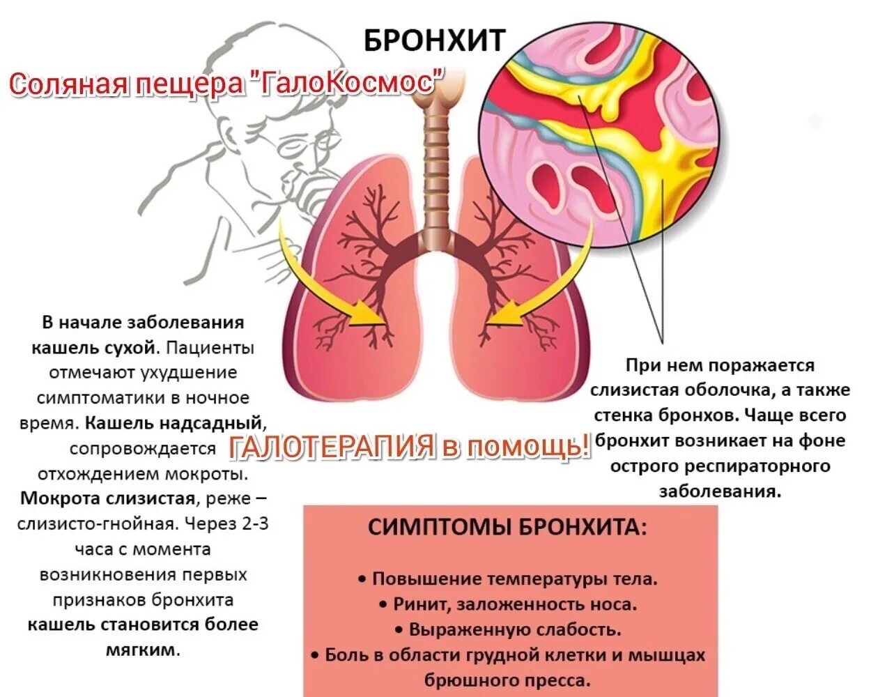 На выдохе кашель с мокротой